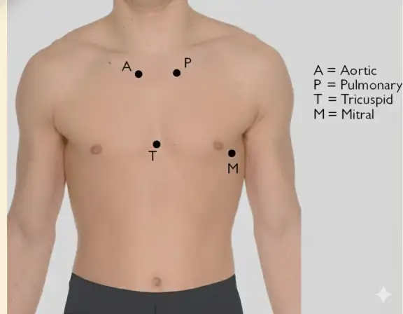 A pic of Auscultation Areas